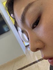 -长沙雅美医疗美容医院