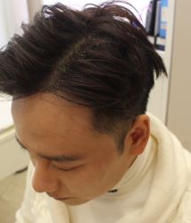 -大麦微针植发全国连锁