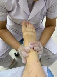 -派恩宜灰指甲鸡眼嵌甲手足癣