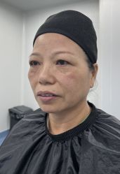 -天津健丽·去眼袋医疗美容机构