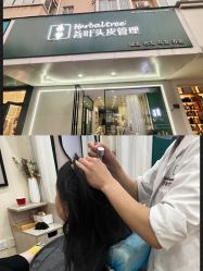 -菩叶脱发白发中心