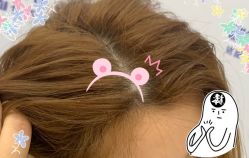 -大麦微针植发全国连锁