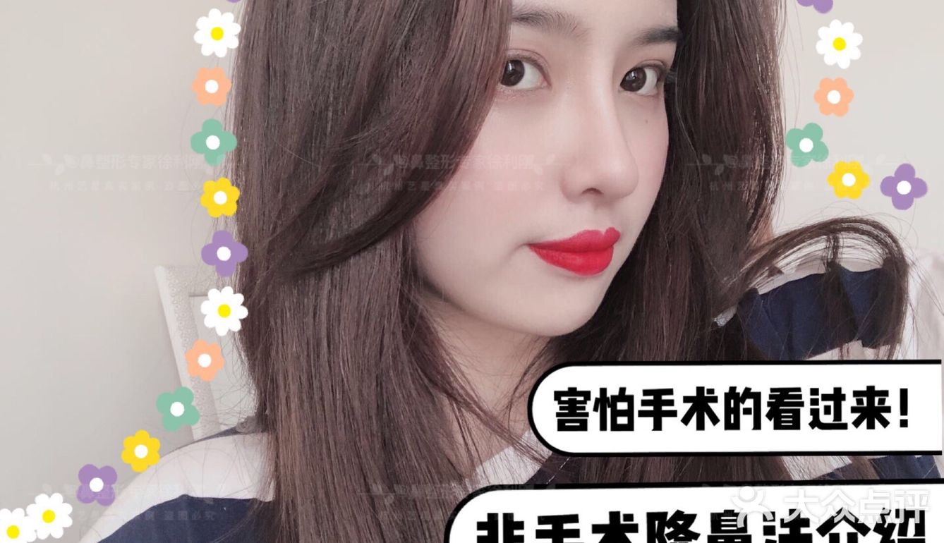 害怕手术的看过来！非手术隆鼻法介绍～