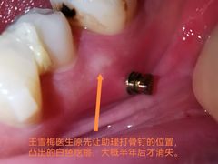 -极光口腔·矫正种植修复(锦江店)