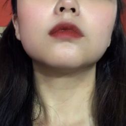 体验前-美莱医学美容医院