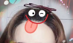 -大麦微针植发全国连锁