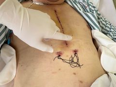 -上海永慈康复医院