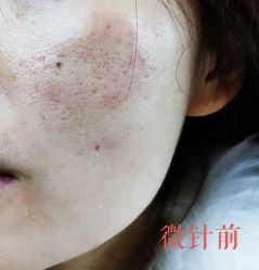-晶禾臻语·问题肌研究所