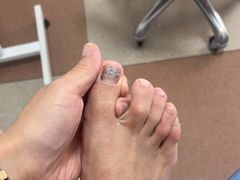 -世龙世家灰指甲鸡眼脚气甲沟炎跖疣护理(通州店)