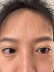 -海涛医疗美容·面部抗衰·注射美鼻