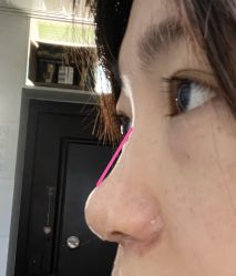 体验前-上海玫瑰医疗美容医院