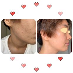 -小忠丽格医美