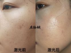 -青岛诺德医学美容医院
