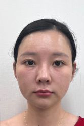 -广州曙光医学美容医院