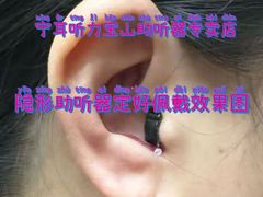 -宁耳听力助听器奥迪康·峰力·西门子(宝山店)
