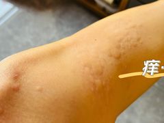 -杭州市第三人民医院