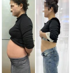 -Fundi张玉珊修身堂·indiba·BTL科技瘦身