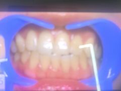 -极光口腔·矫正种植修复(锦江院区)