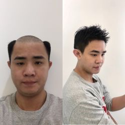 -发饰美男士增发补发假发定制店