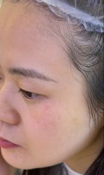 -长沙雅美医疗美容医院