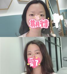 -久匠半永久纹眉