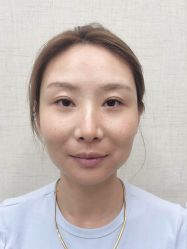 点击看大图 体验前-深圳艺星医疗美容医院