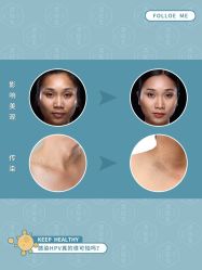 -清疣美疣·痣·斑净肤中心