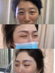 点击看大图 体验后-重庆联合丽格第五医疗美容医院