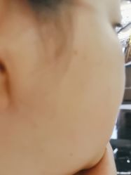 -美瑞莎创美医疗美容
