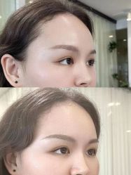点击看大图 -张小野·专业半永久纹眉