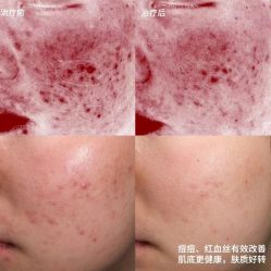 -尊尚柏丽美容SPA