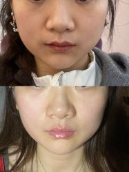 -美莱医学美容医院