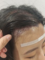 -熙朵美学植发·连锁品牌