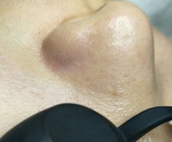 -汐月Health纤体spa中心