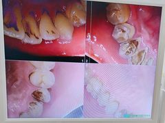 -佛山中大口腔医院·市二级口腔专科医院