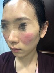 -北京米扬丽格医疗美容·联合丽格鼻整形中心