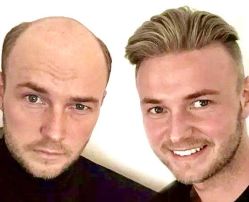 -发饰美男士增发补发假发定制店