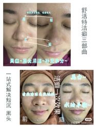 -安吉拉青春化管理中心