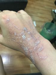 -一次性洗纹身·修复疤痕·超皮秒