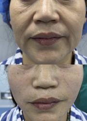 -郡艺医疗美容·微整·眼鼻吸脂