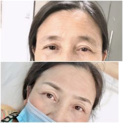 -Doris多里斯半永久纹眉·SMP纹发·发际线