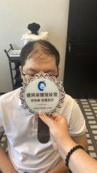 -唐风采假发补发定制
