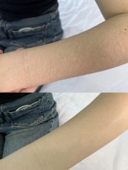 -杭州米兰柏羽医疗美容医院