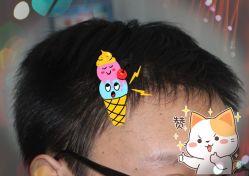 -大麦微针植发全国连锁