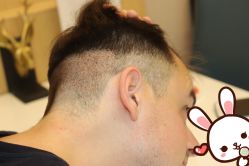 -大麦微针植发丨全国连锁