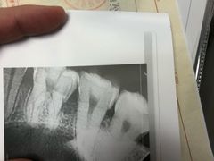 -上海市杨浦区牙病防治所