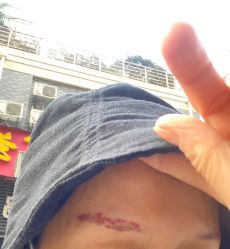 -郡艺医疗美容·微整·眼鼻吸脂