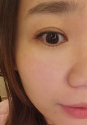 -宥莉·ULLY 痘敏肌•科技皮肤管理中心