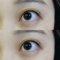 -Younger Skin·科技氧肤中心