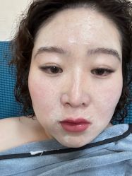 体验后-深圳阳光医疗美容医院·旗舰店